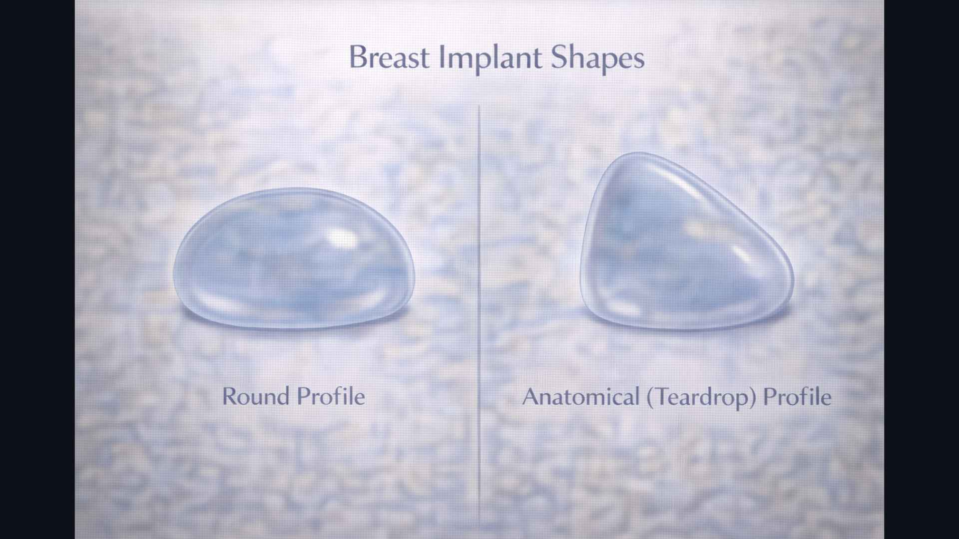 Diagram showing different breast implant shapes — round vs anatomical teardrop profiles