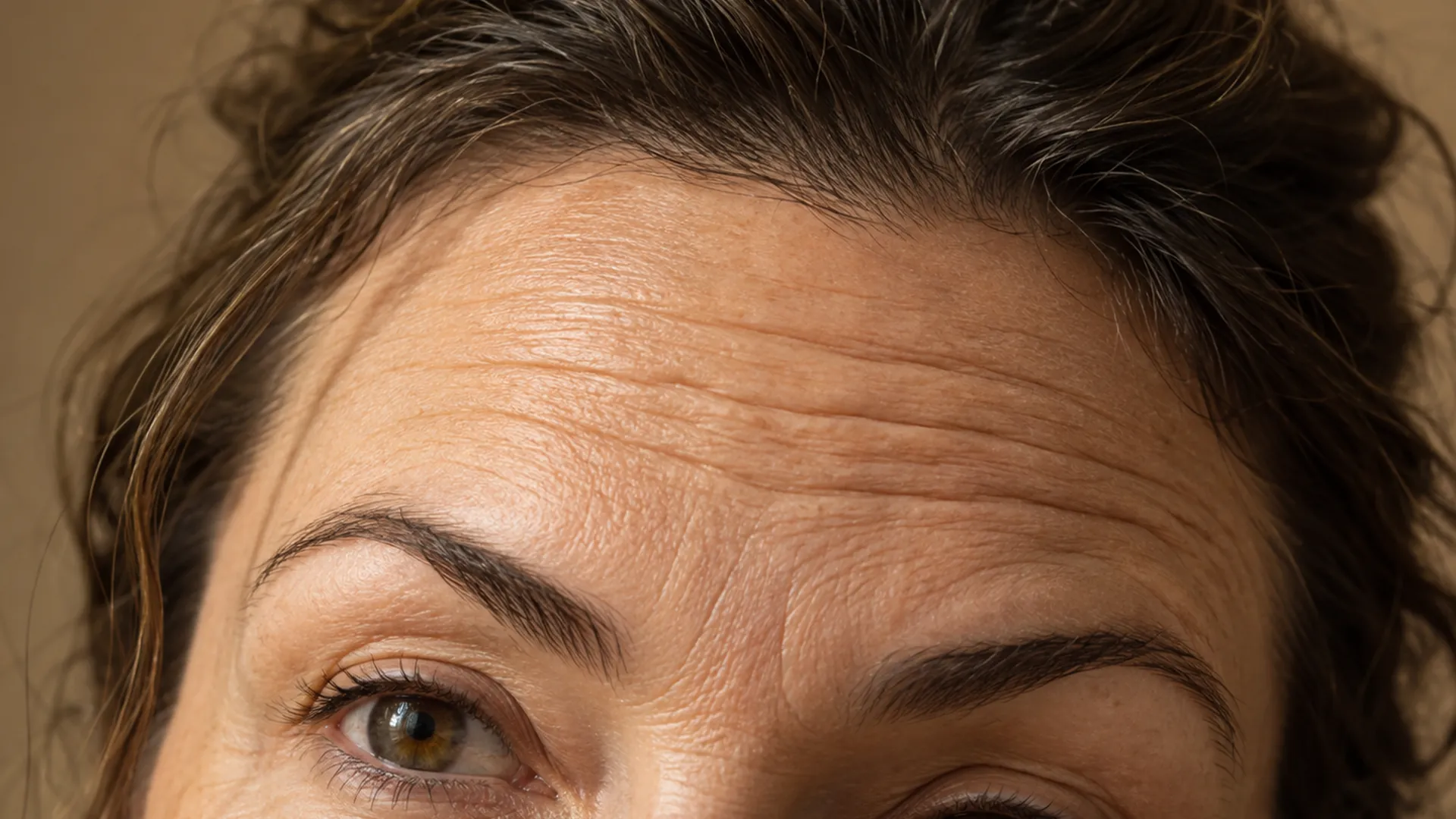 Close-up of a forehead lit from the side, eyebrows half raised, showing the difference between lines that appear on movement and lines etched at rest