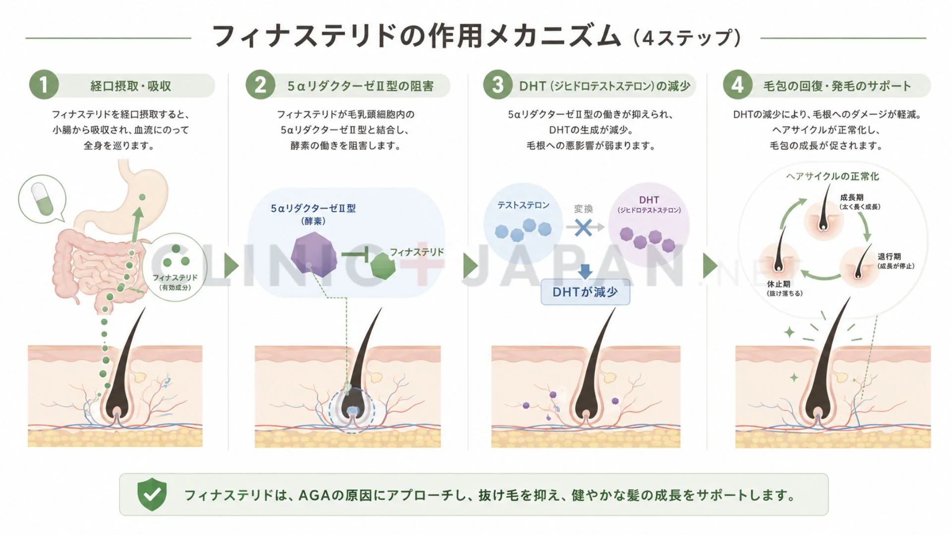 フィナステリドの作用機序 — 5α還元酵素II型阻害によるDHT産生抑制の4段階