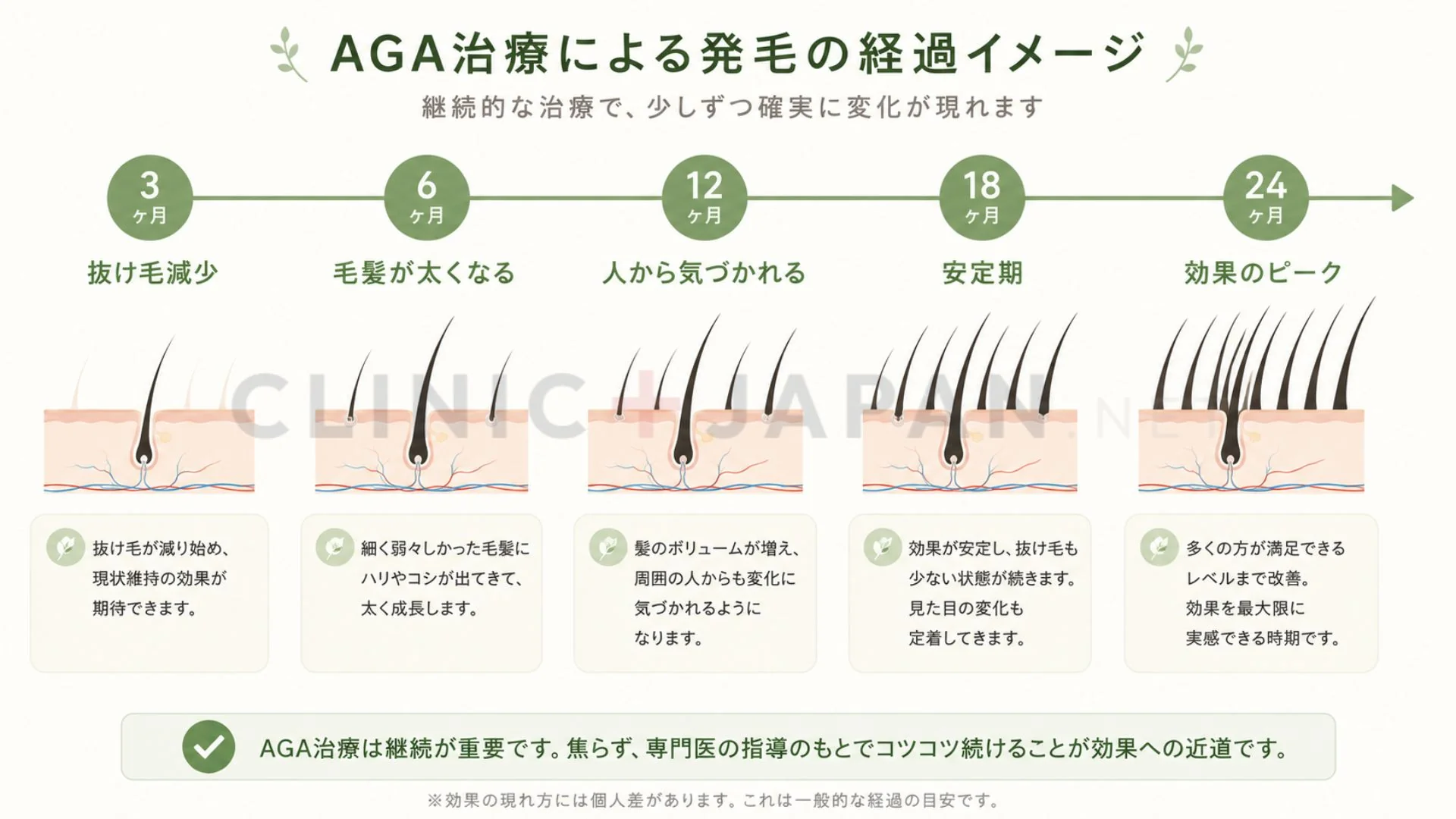 AGA治療の発毛タイムライン — 3か月・6か月・12か月・24か月の経過と毛髪密度の推移