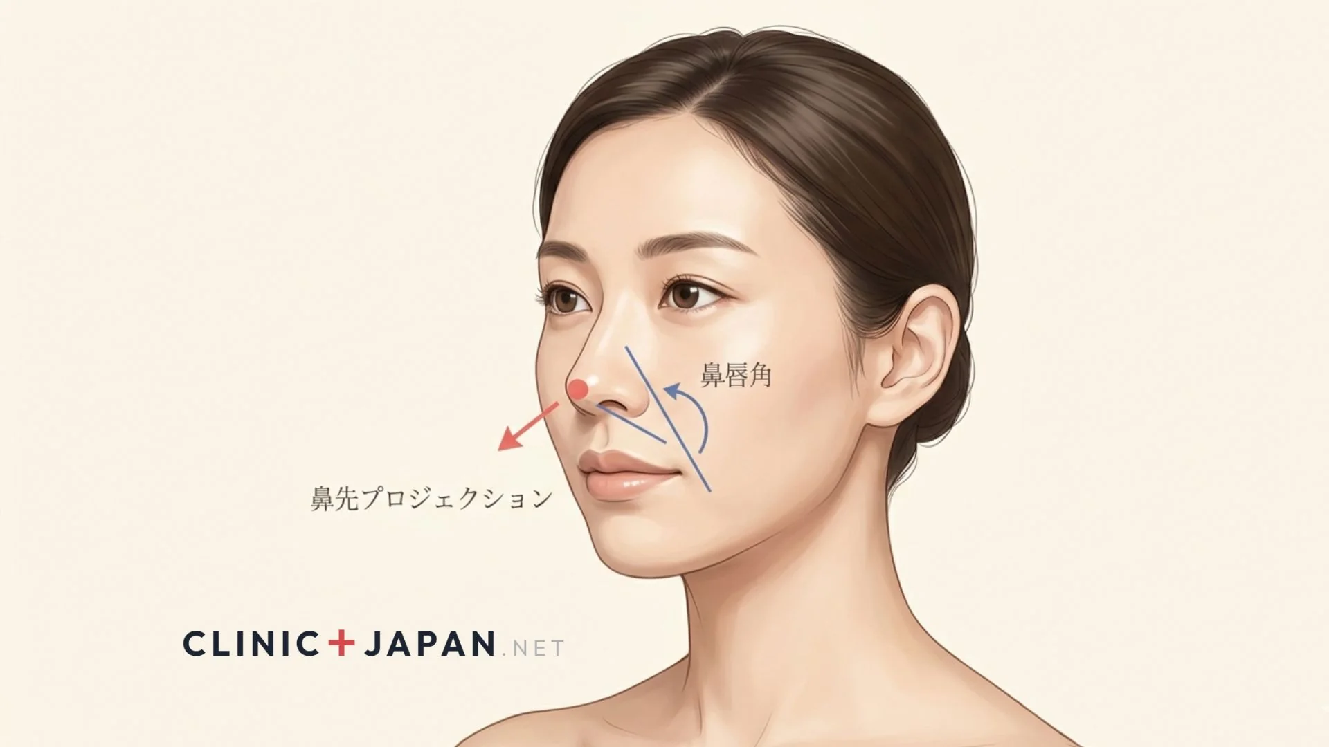 鼻中隔延長 — SEGによる短い鼻・上向き鼻先の修正