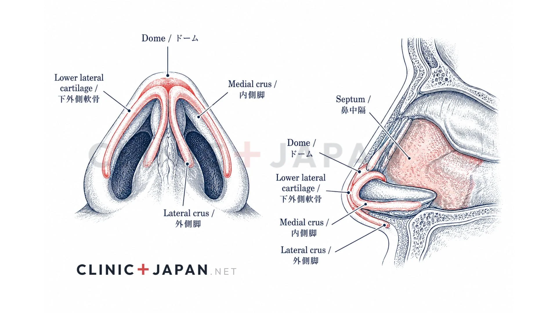 鼻尖縮小の解剖図 — 下外側軟骨(LLC)の構造とdomeの位置関係・操作部位の整理