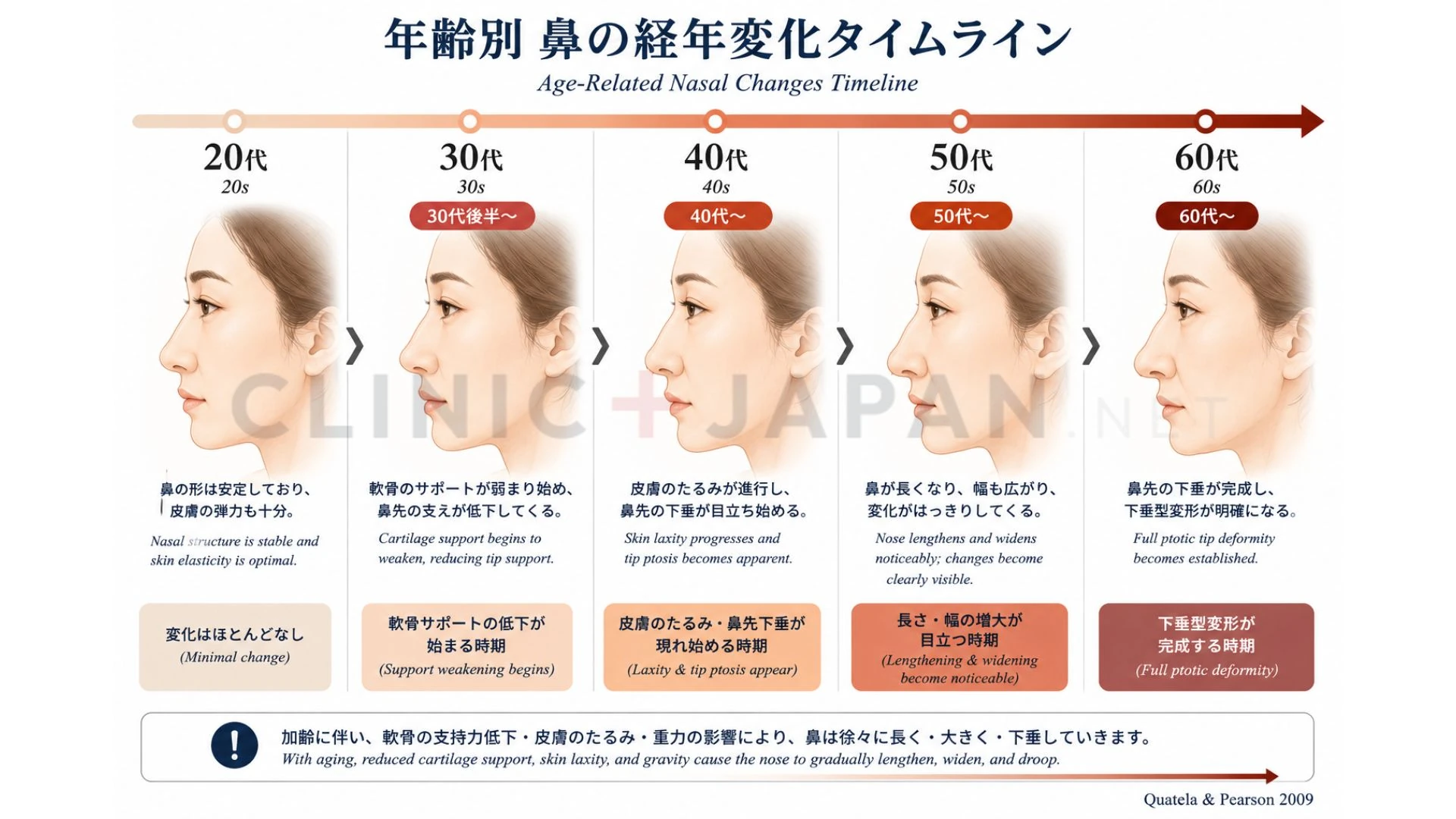 原因別の治療選択 — 鼻の変化への対処