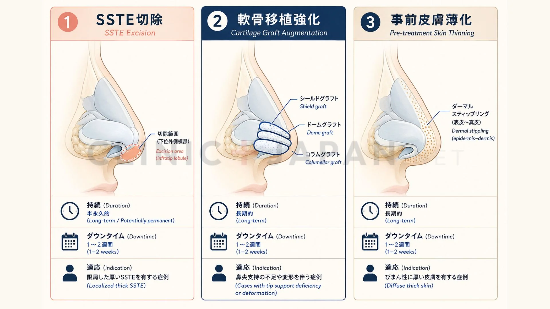 鼻の皮膚が厚い場合の3つの対処法 — SSTE切除・軟骨移植強化・事前皮膚薄化