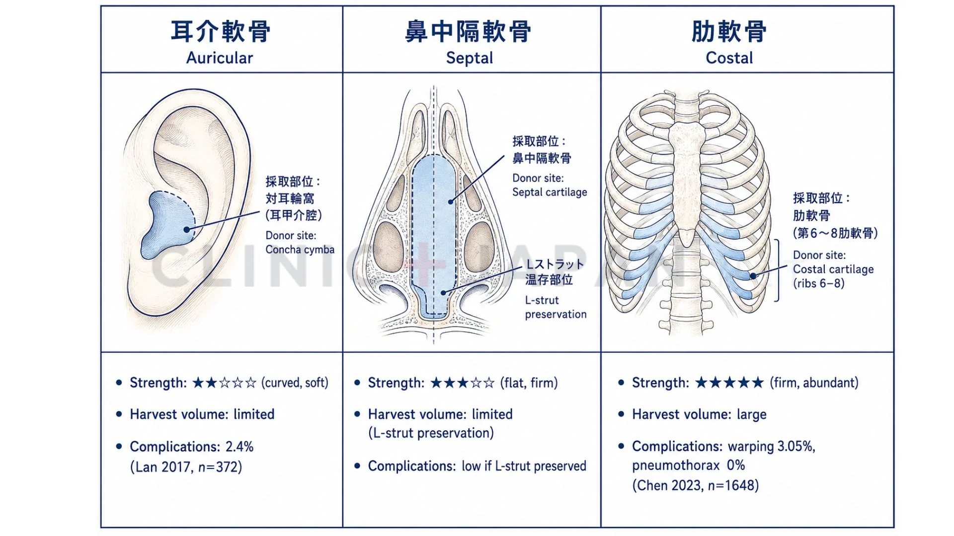 鼻軟骨移植 採取部位の比較 — 肋軟骨・耳介軟骨・鼻中隔軟骨の強度・採取量・合併症発生率