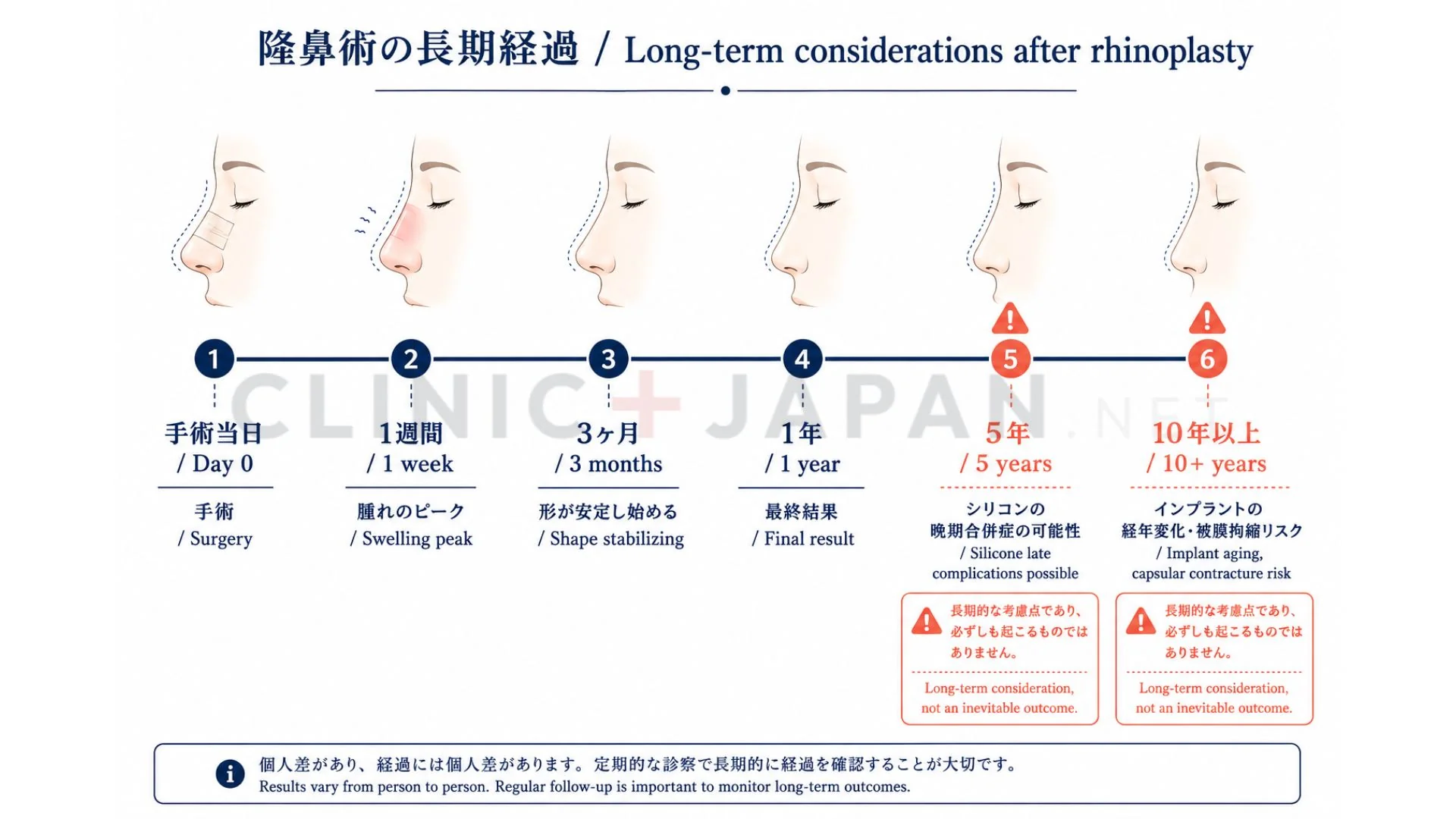 鼻整形の合併症・修正リスクの時系列イメージ