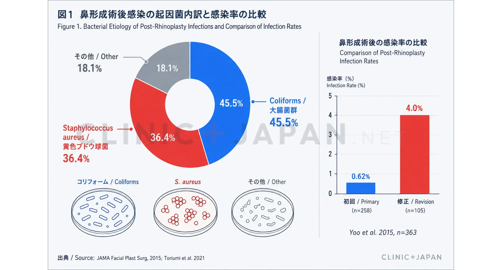鼻整形の感染症 — 原因菌の内訳（Coliforms 45.5%・黄色ブドウ球菌 36.4%・その他 18.1%）と糖尿病患者の保菌特徴