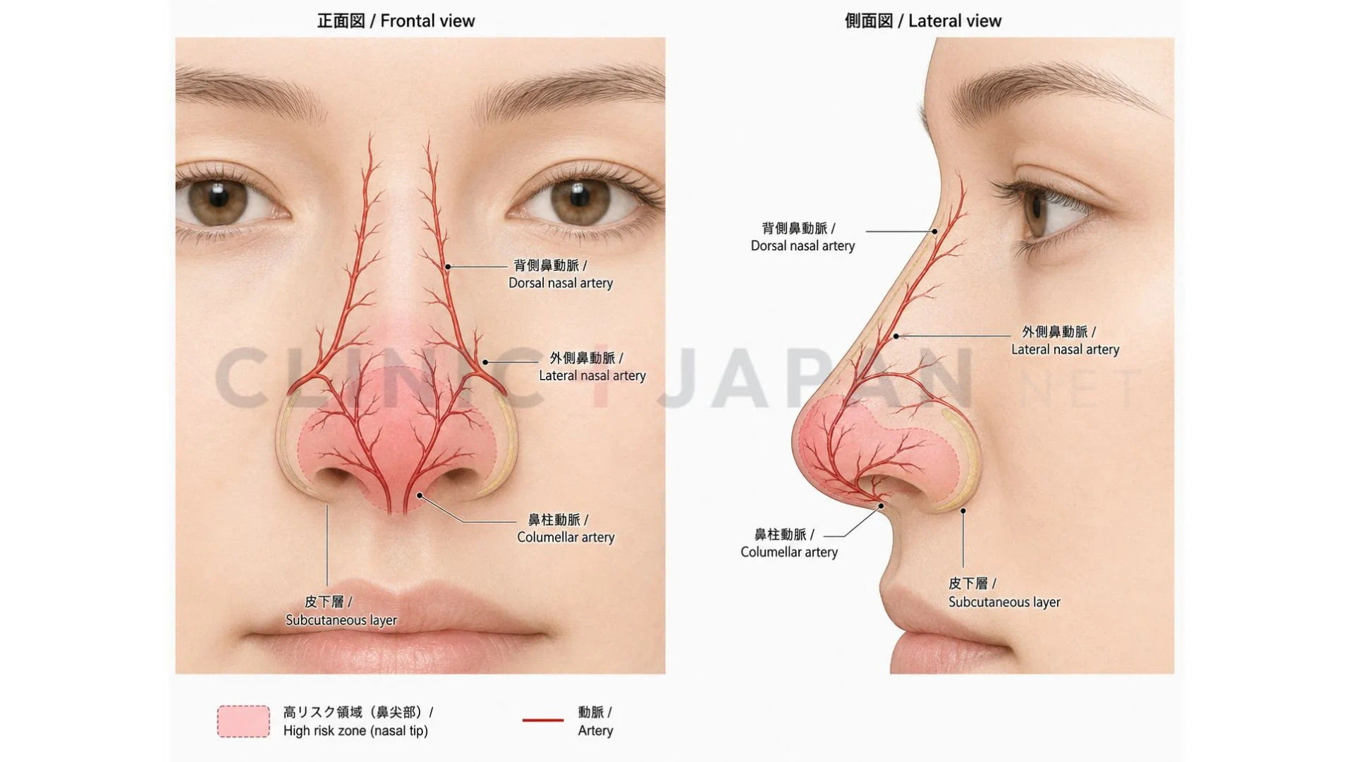 鼻先の血管解剖図 — 外側鼻動脈・背側鼻動脈・鼻柱動脈と注入危険ゾーン