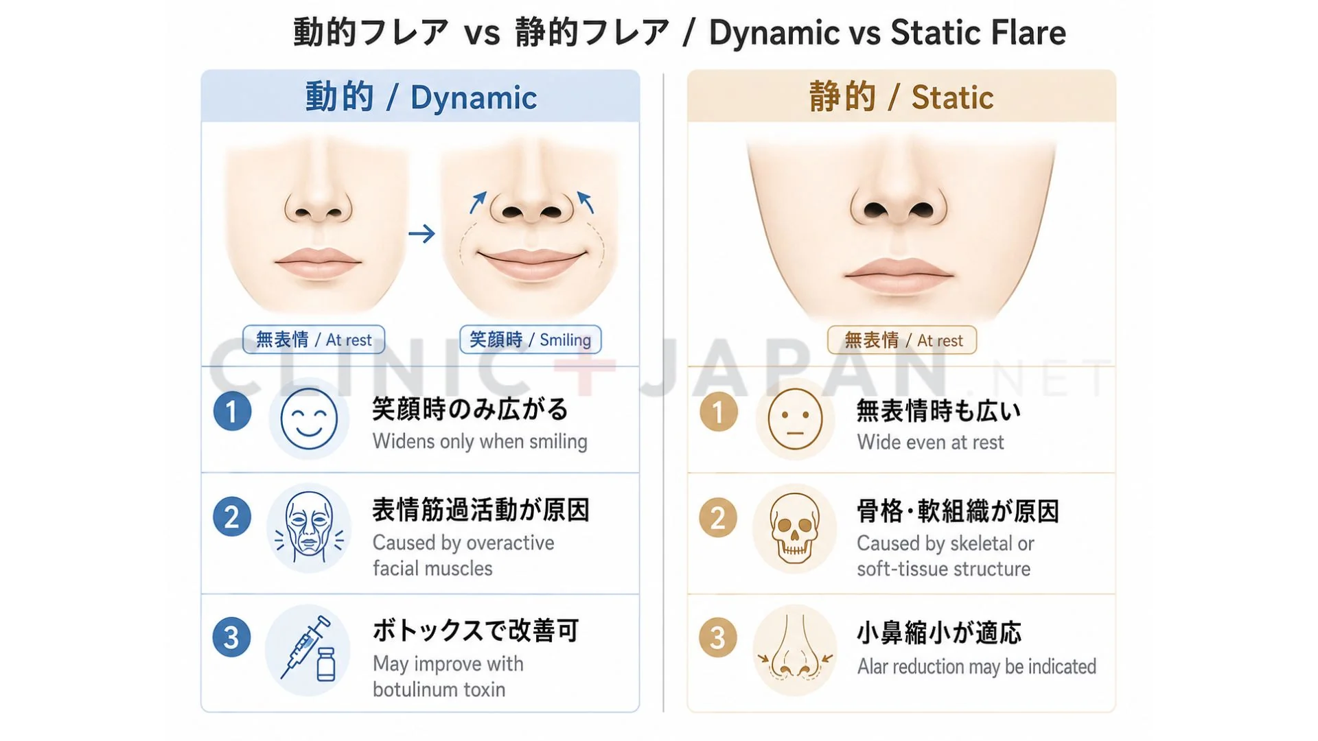 小鼻ボトックス注入ポイント — 鼻筋の鼻翼部・鼻孔拡張筋・上唇鼻翼挙筋の位置と用量