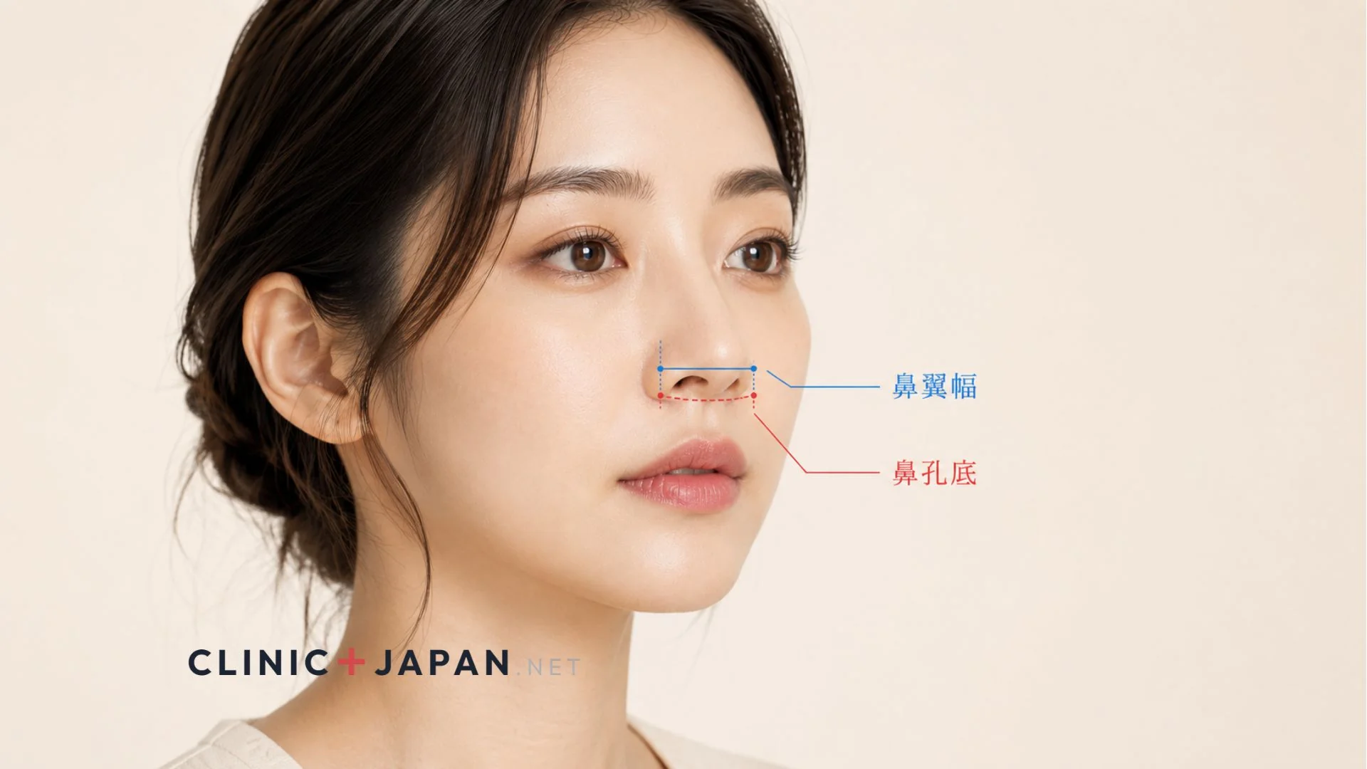 小鼻縮小 — 鼻翼縮小手術の3術式と効果の全体像