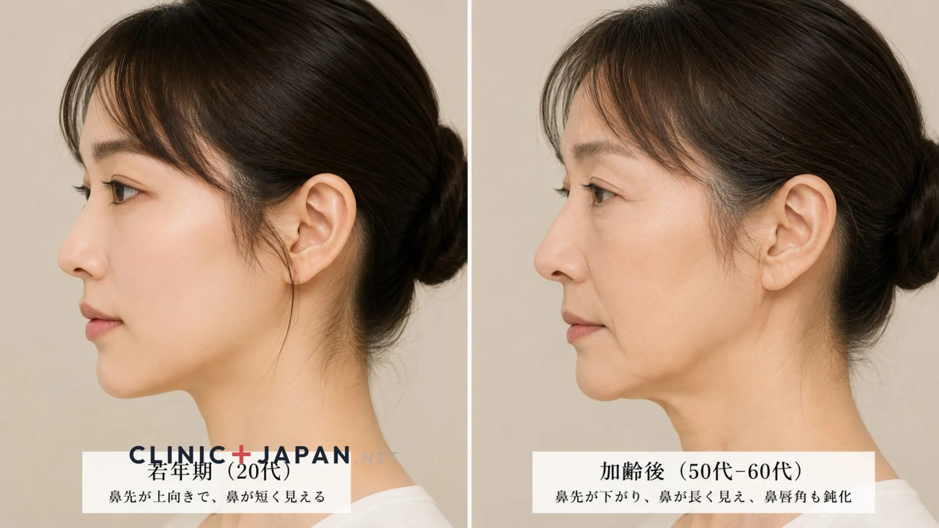 垂れ鼻 — 加齢による鼻先下垂と印象の変化のメカニズム