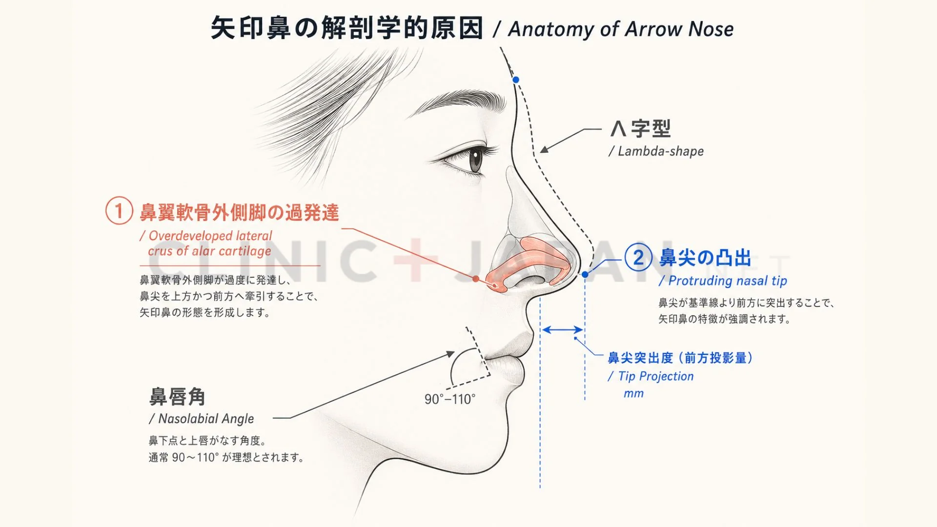 矢印鼻の「Λ字型」を作る解剖学的要素