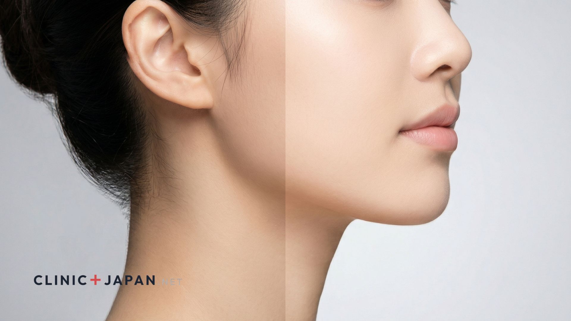 エラボトックスの効果イメージ