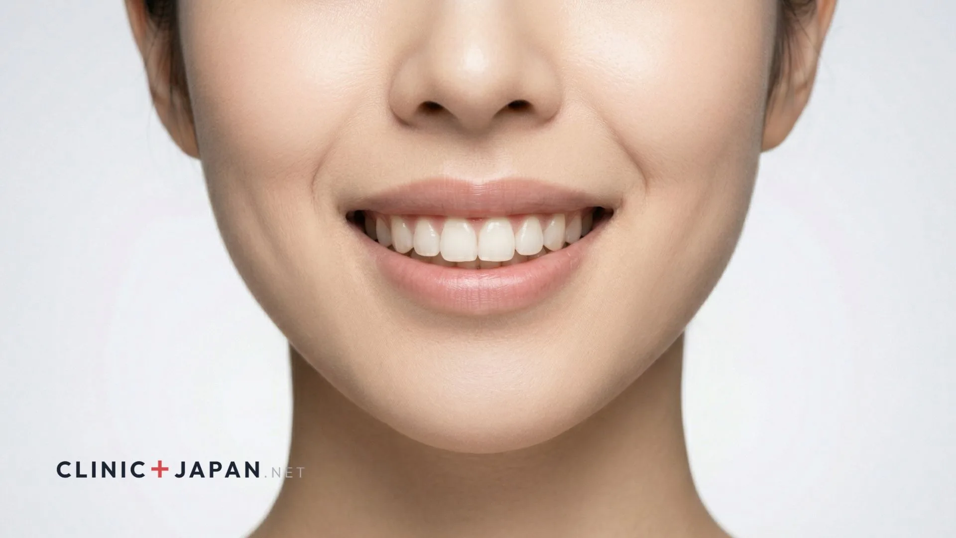 ガミースマイルボトックス