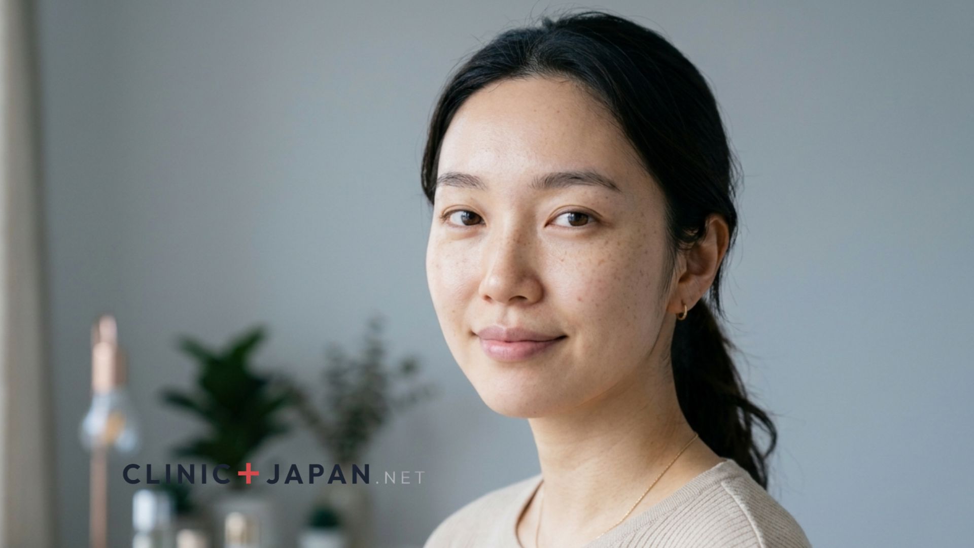 人中ボトックスのイメージ — 口輪筋への注入でリップフリップ効果