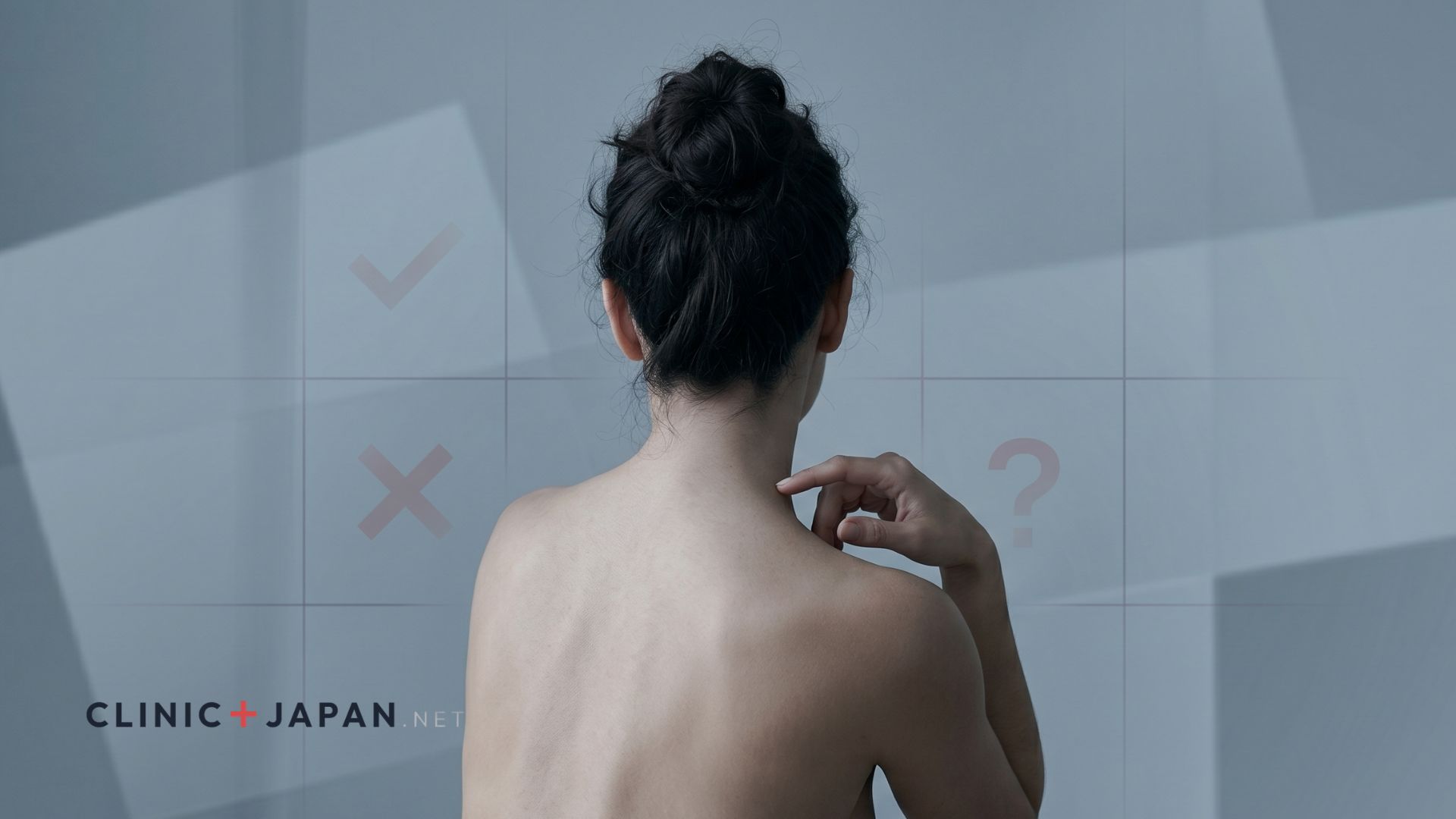 肩ボトックスの失敗・後悔パターンと対策