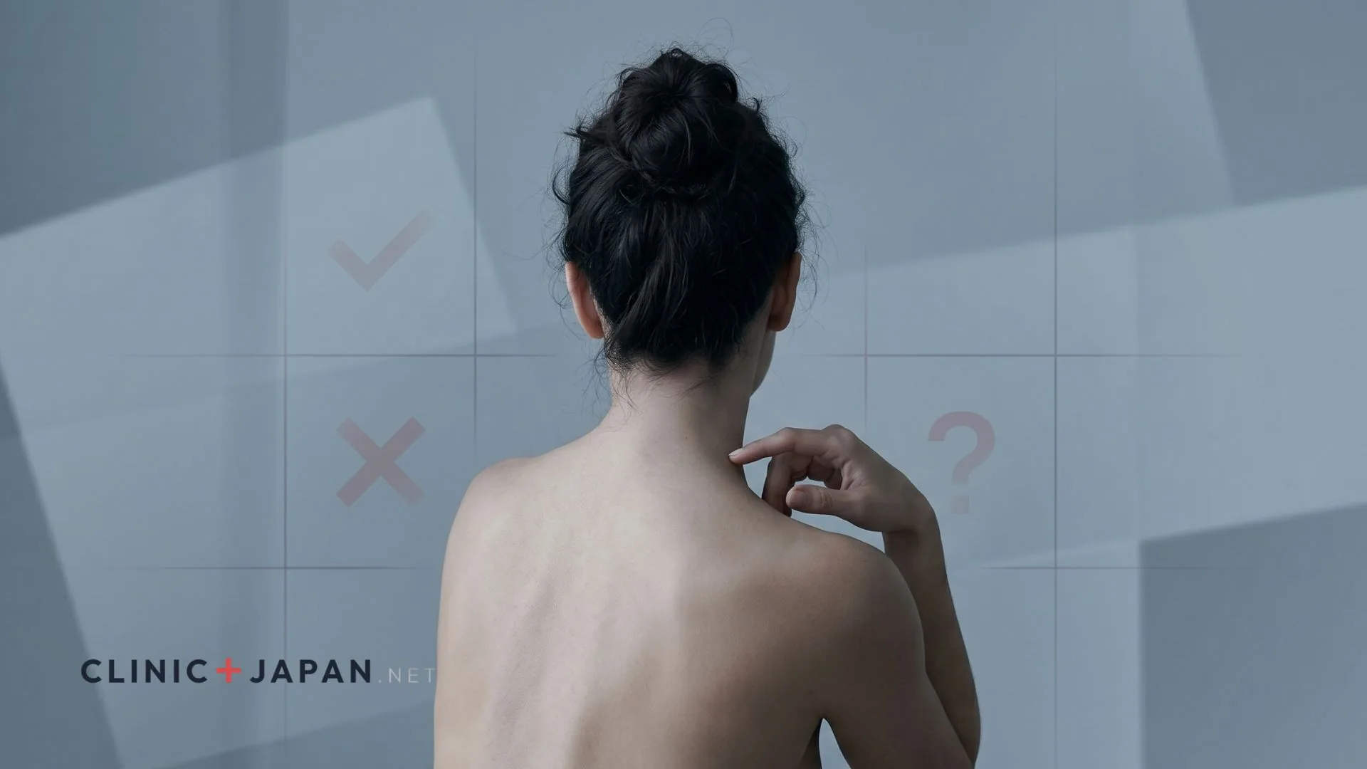 肩ボトックスの失敗・後悔