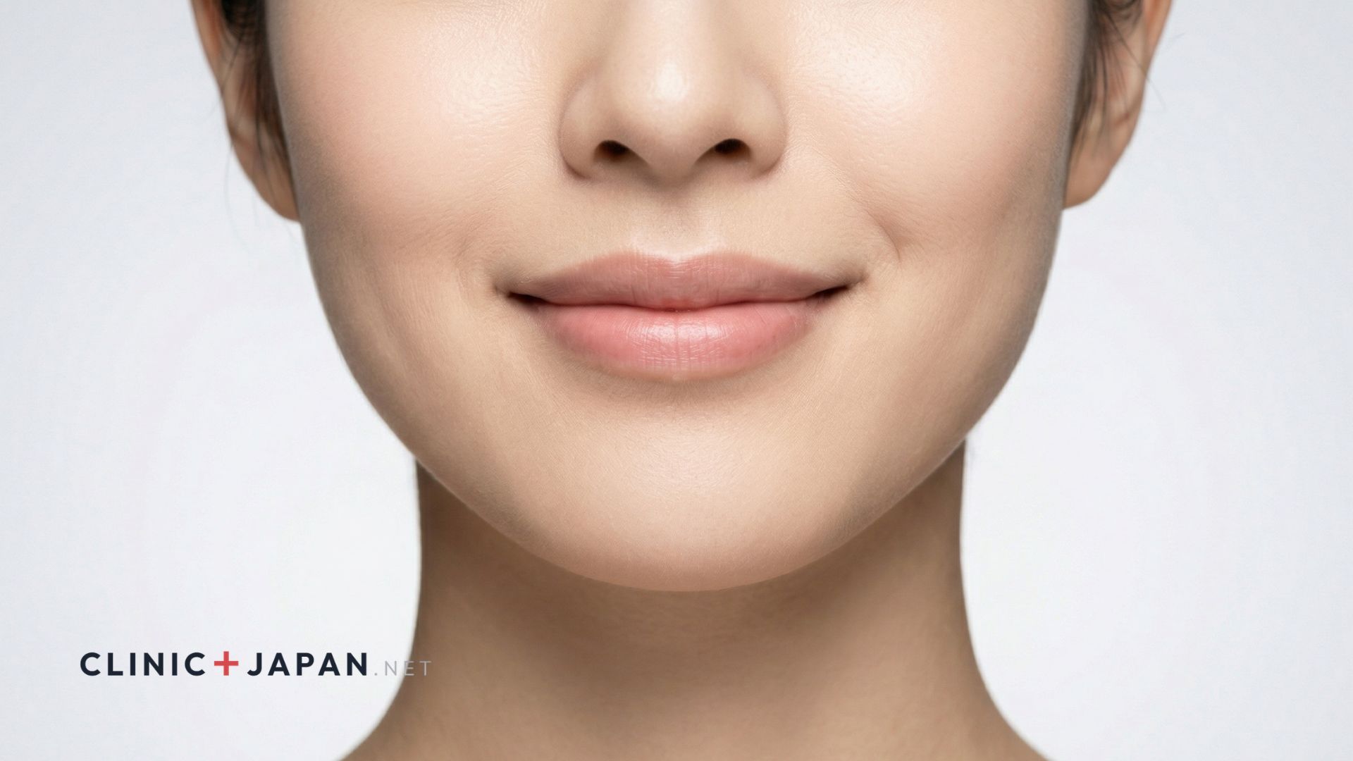 口角ボトックス — 口角下制筋への注射で自然な微笑み口元へ