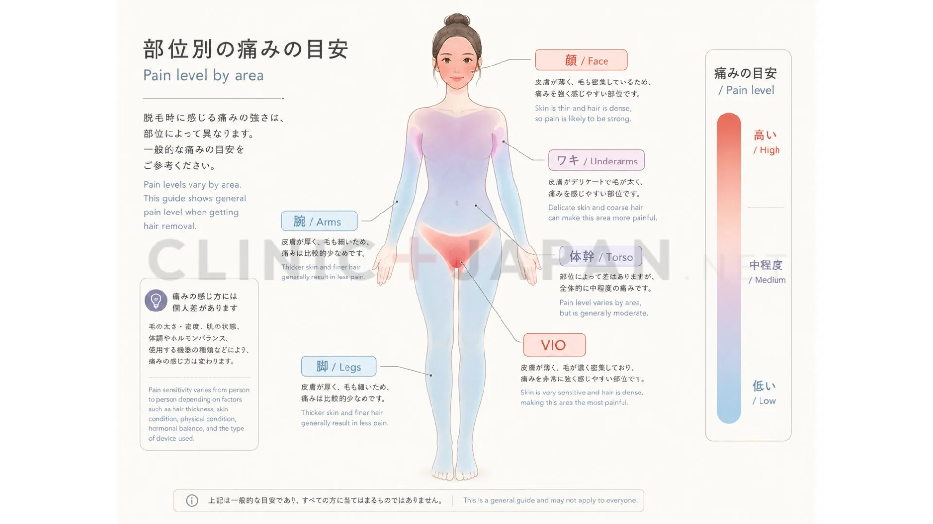 医療脱毛の部位別の痛みの目安 — ワキ・VIO・顔など部位ごとの痛みの強さ