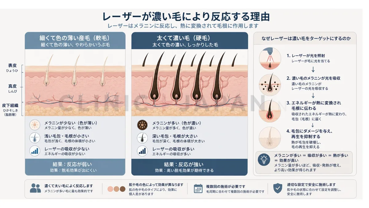 産毛と太い毛の違いを示した断面図