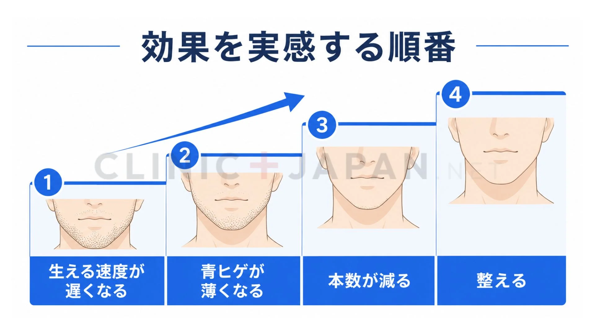 ヒゲ脱毛の効果が生えるスピード低下から青ヒゲ減少・本数減少へと段階的に進む順番を示した図