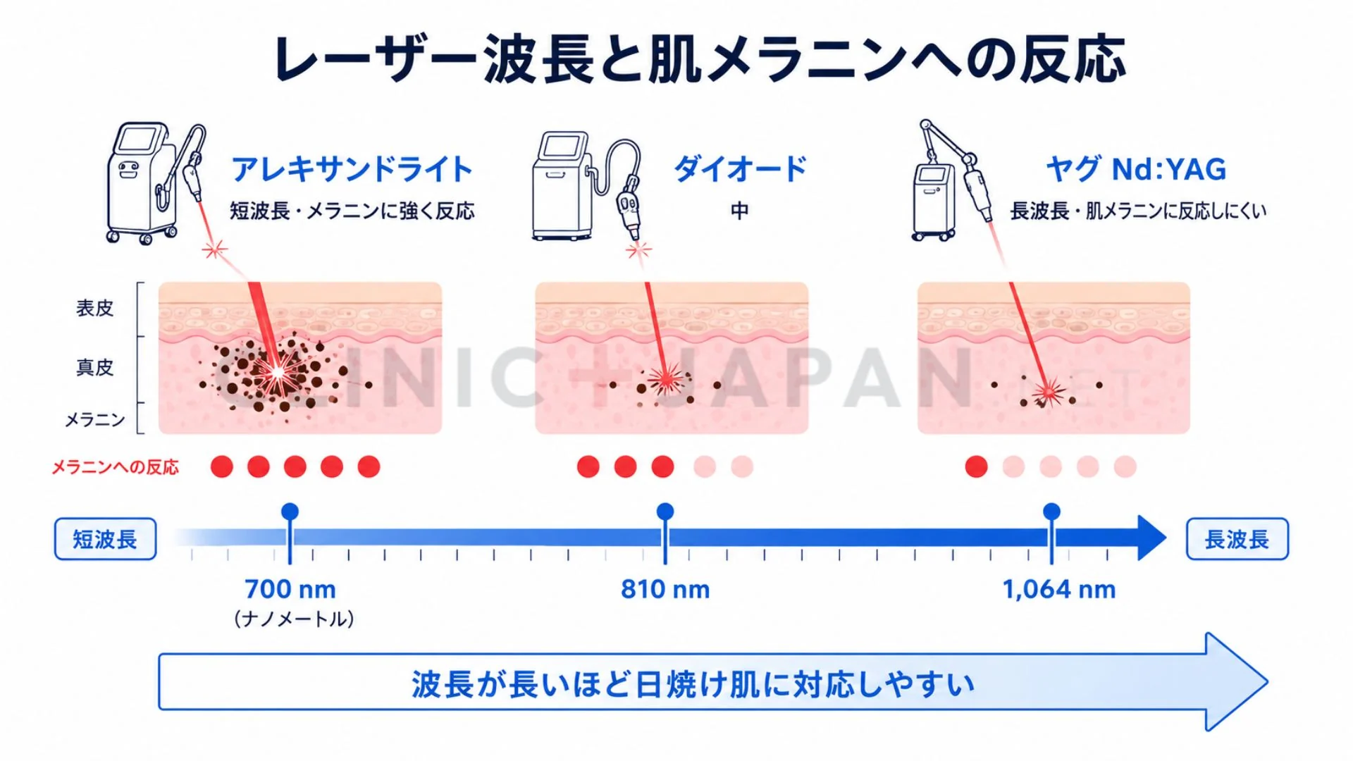 アレキサンドライト・ダイオード・ヤグの波長の違いと肌メラニンへの反応しやすさを示した図解