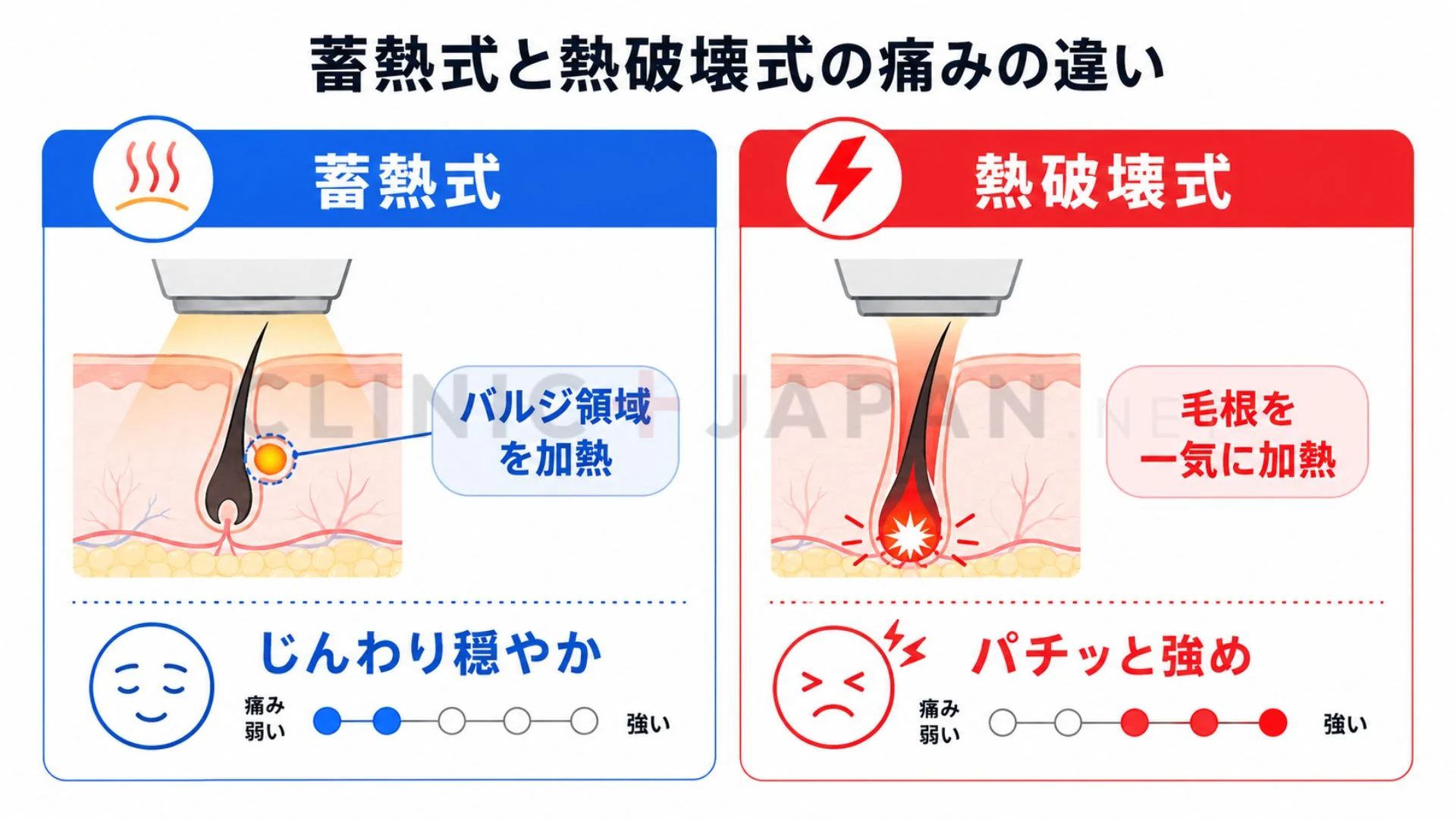 蓄熱式と熱破壊式で痛みの感じ方が異なることを示した比較図解
