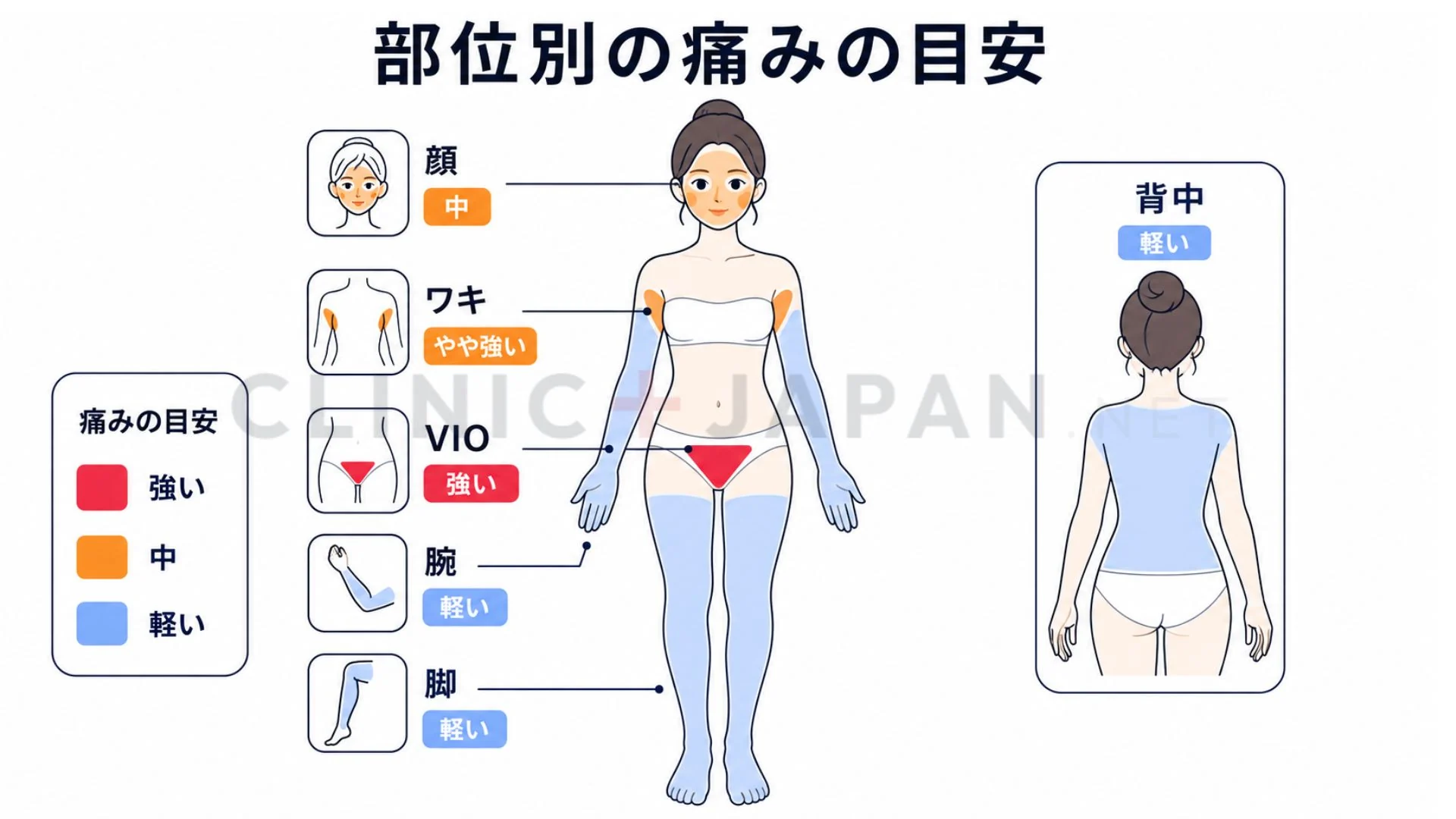 顔・ヒゲ・ワキ・VIO・腕脚など部位別の痛みの強さを色分けで示した図解