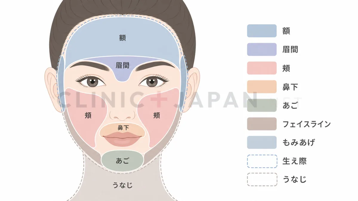 顔脱毛の範囲を部位ごとに示したマッピング図