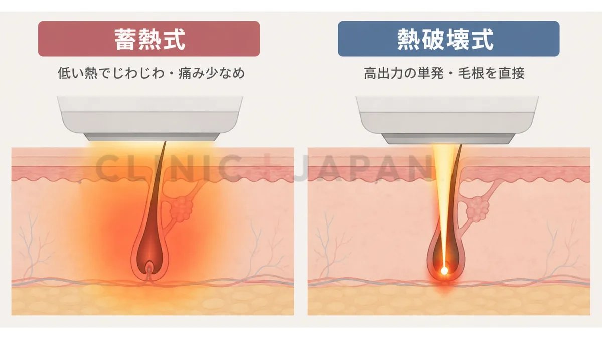 蓄熱式と熱破壊式の違いを示した図