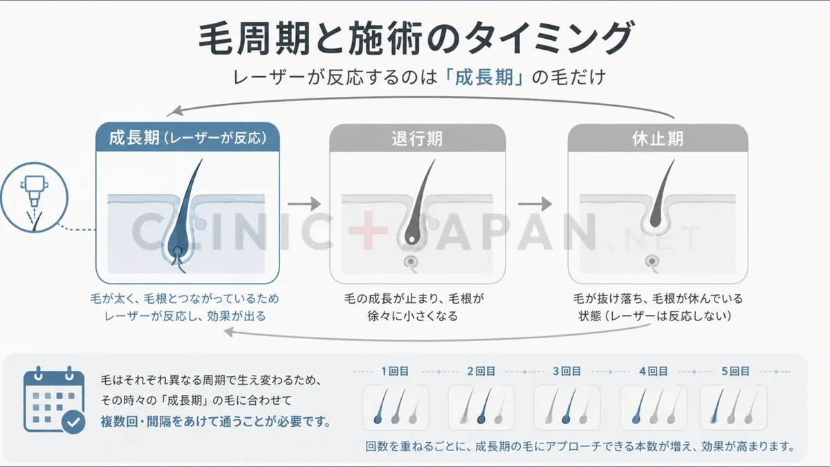 毛周期と施術のタイミングの関係を示した図