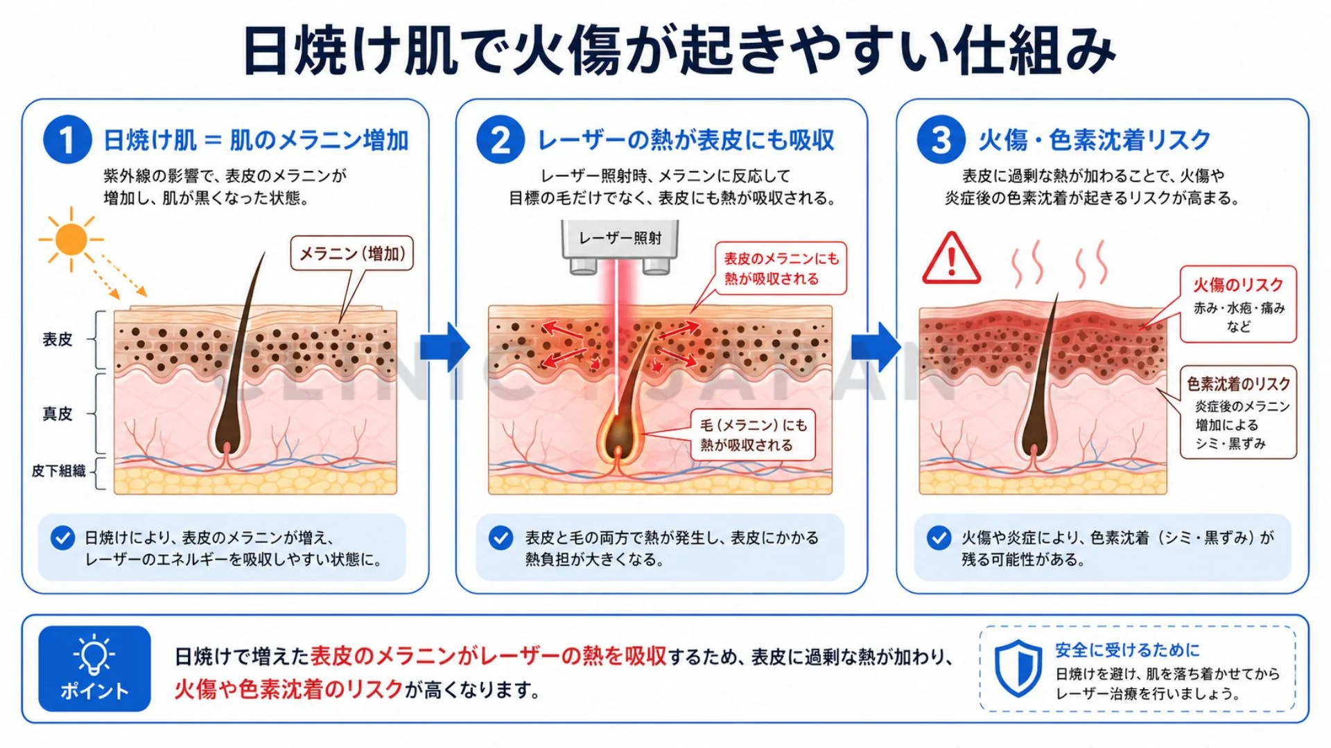 日焼け肌でメラニンが増え熱が表皮に集中して火傷が起きる仕組みを示した概念図