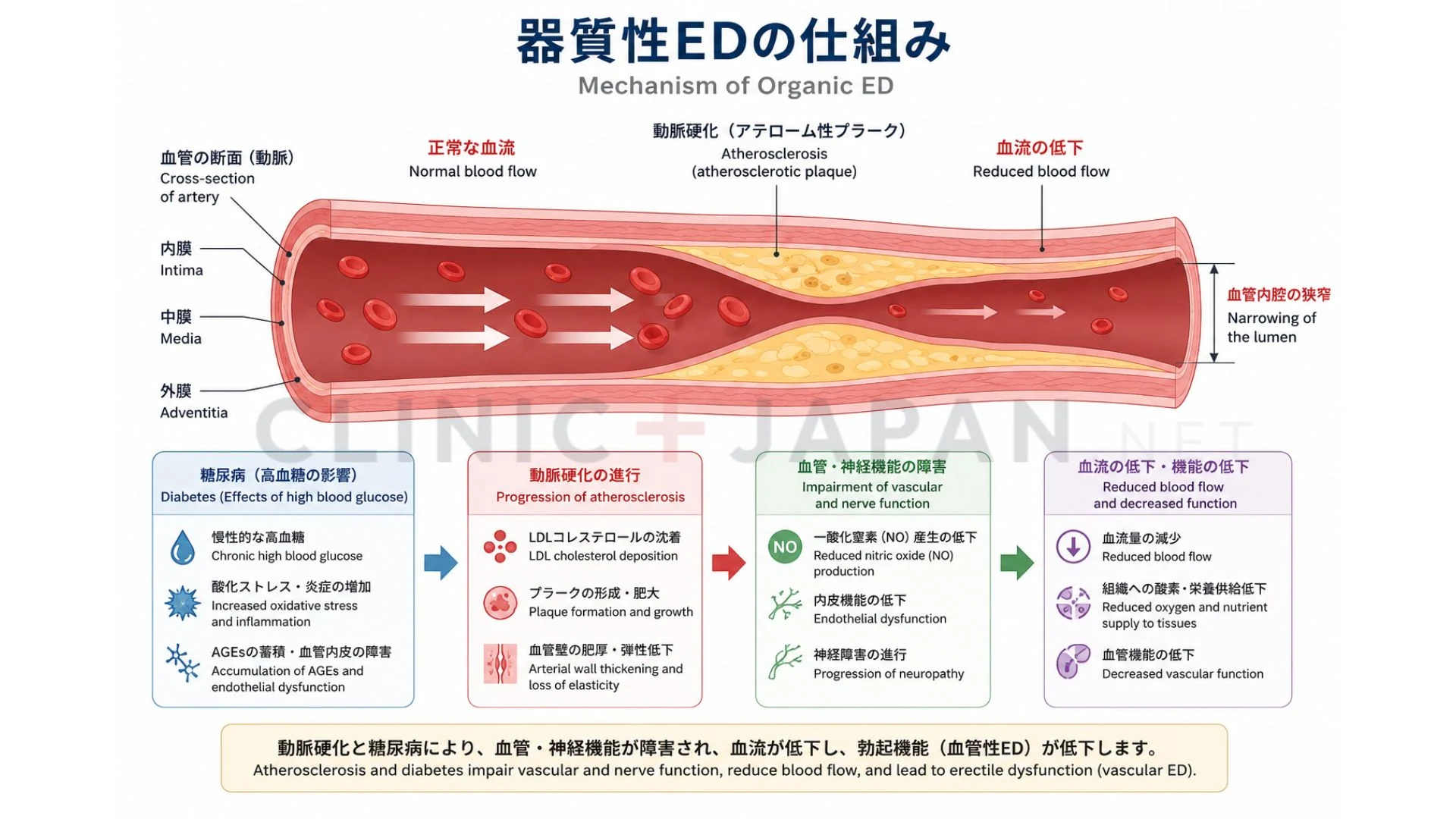 動脈硬化や糖尿病による血管・神経の障害が陰茎への血流を妨げ、器質性EDを起こす仕組みを示した図