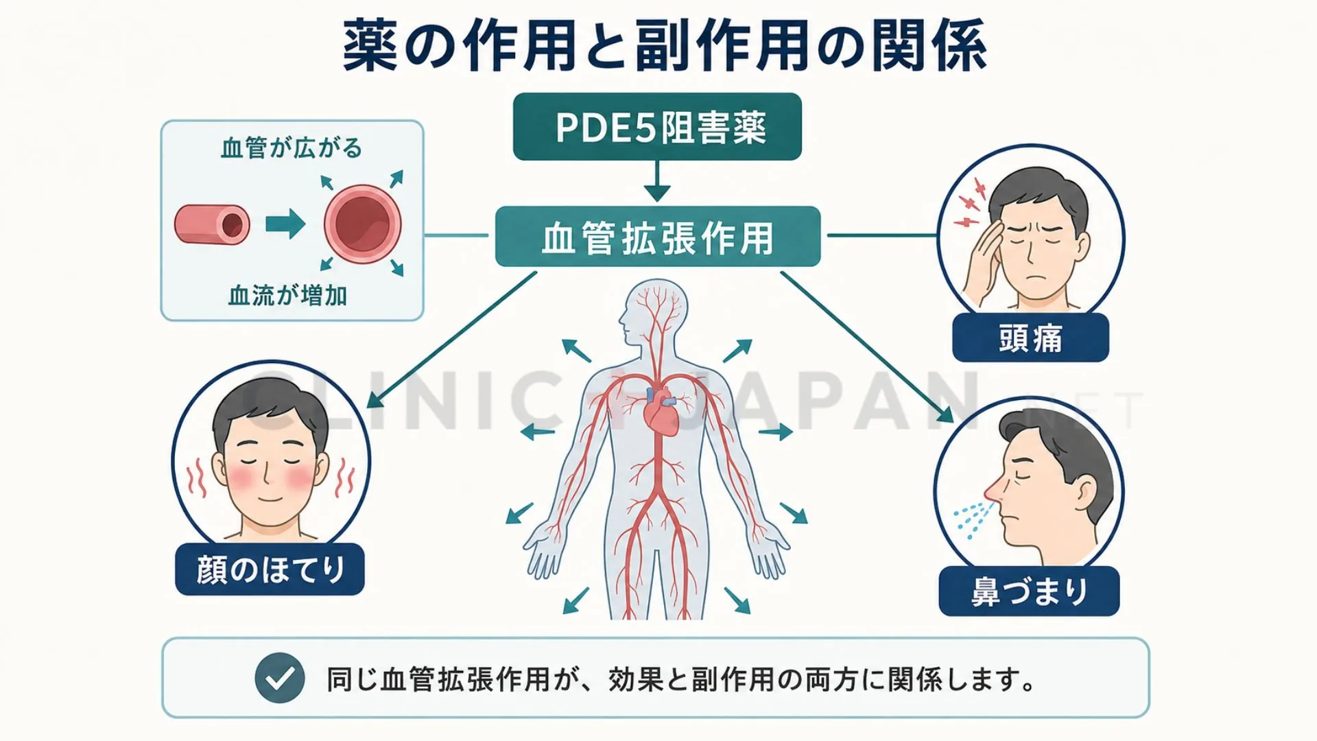 ED治療薬（PDE5阻害薬）の血管拡張作用と、それに関連して起こる副作用の関係を整理した図