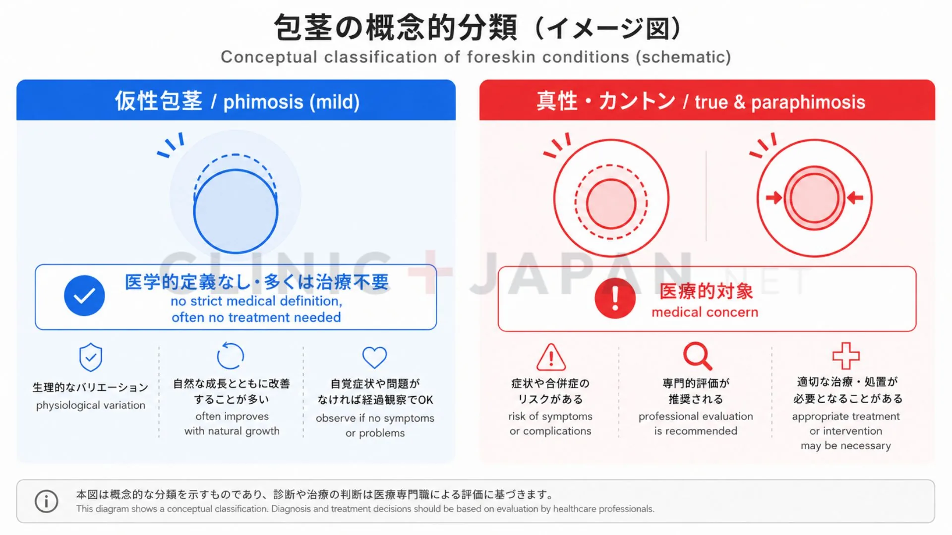 仮性包茎は医学的定義がなく治療不要、真性・カントンは治療対象という違いを示した図
