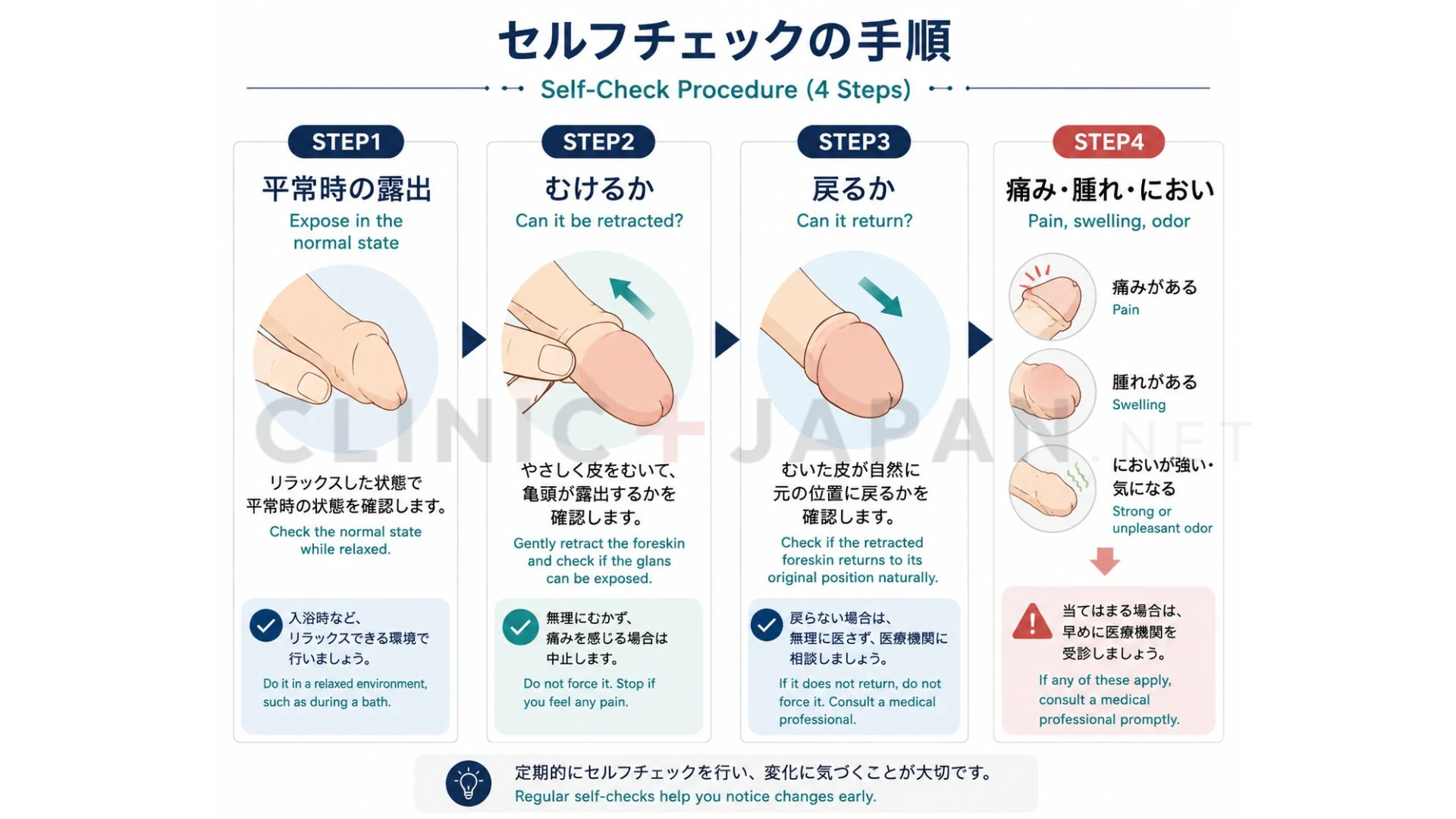 むける・むいたあと戻る・痛みや腫れの有無という3ステップで包茎のタイプを確認するセルフチェックの手順図
