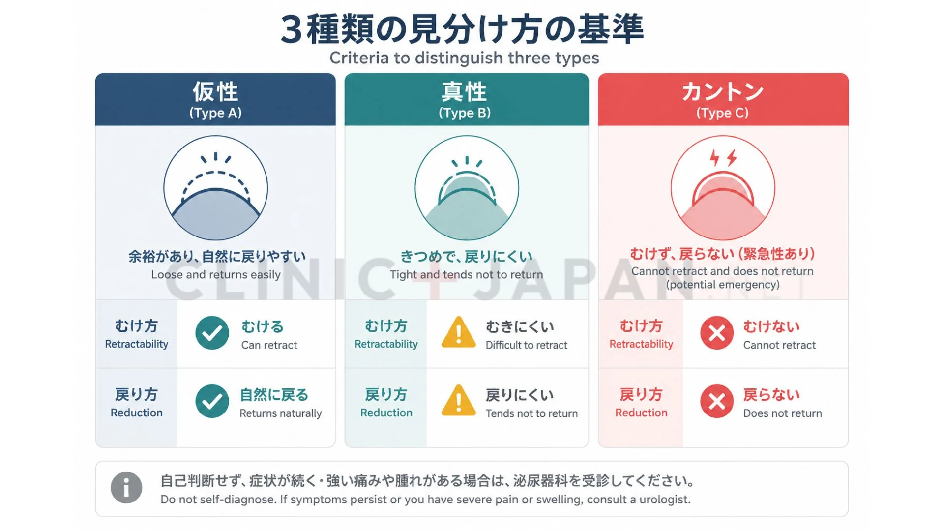 仮性包茎・真性包茎・カントン包茎の3種類を、むけ方と戻り方の観点で比較した医学的な図