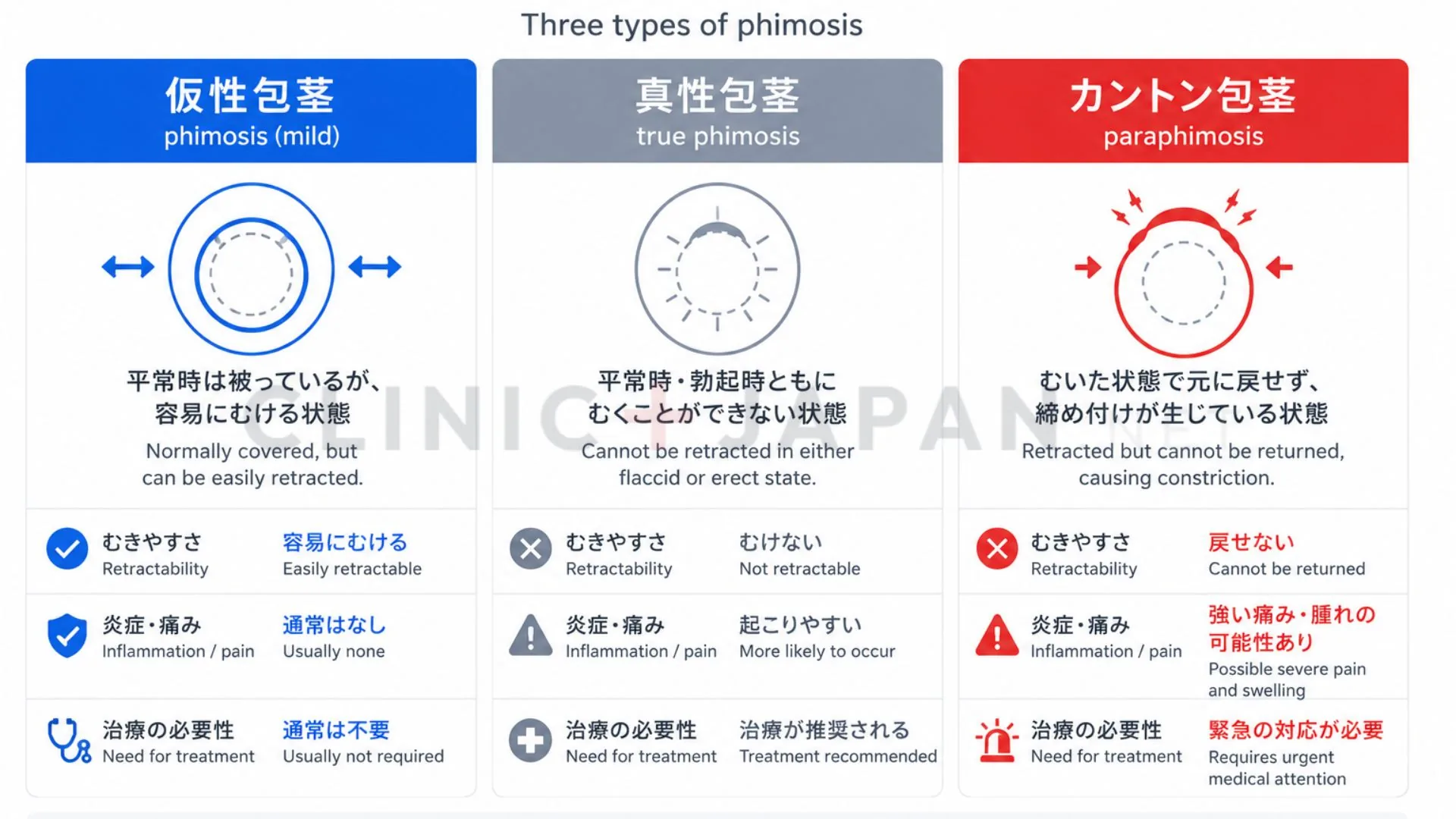 仮性包茎・真性包茎・カントン包茎の3種類の状態の違いを示した医学的な比較図