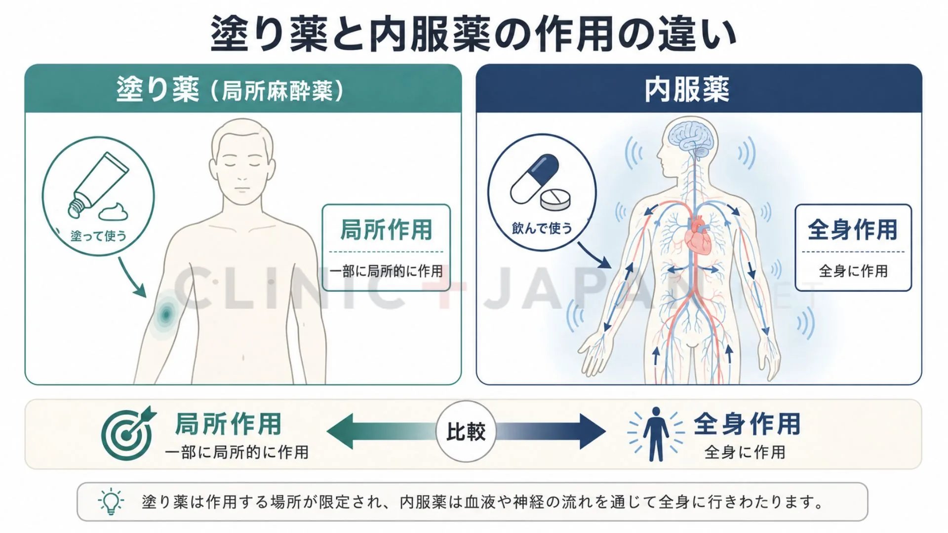 早漏治療薬の塗り薬と内服薬の作用の違い（局所と全身）を整理した図