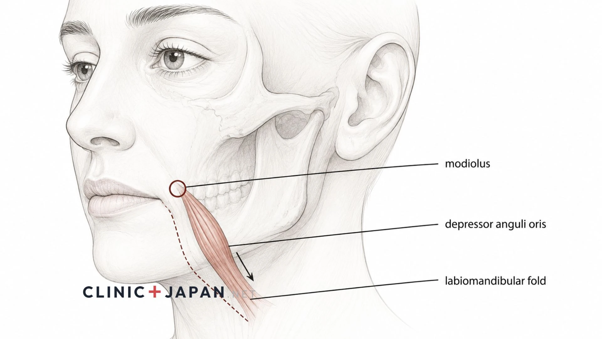 Anatomical illustration of the lower face showing the modiolus at the mouth corner and the depressor anguli oris muscle beneath the labiomandibular fold